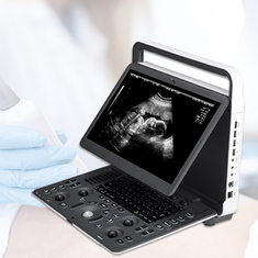 M-Farb-Doppler-Ultraschall Machine Requipo De Ultrasonido Sonoscape E2 Ecografo Herz- Gefäß- Diagnosen-b 2B/4B/