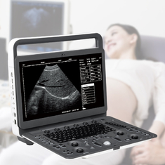 M-Farb-Doppler-Ultraschall Machine Requipo De Ultrasonido Sonoscape E2 Ecografo Herz- Gefäß- Diagnosen-b 2B/4B/