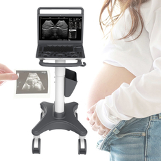 M-Farb-Doppler-Ultraschall Machine Requipo De Ultrasonido Sonoscape E2 Ecografo Herz- Gefäß- Diagnosen-b 2B/4B/